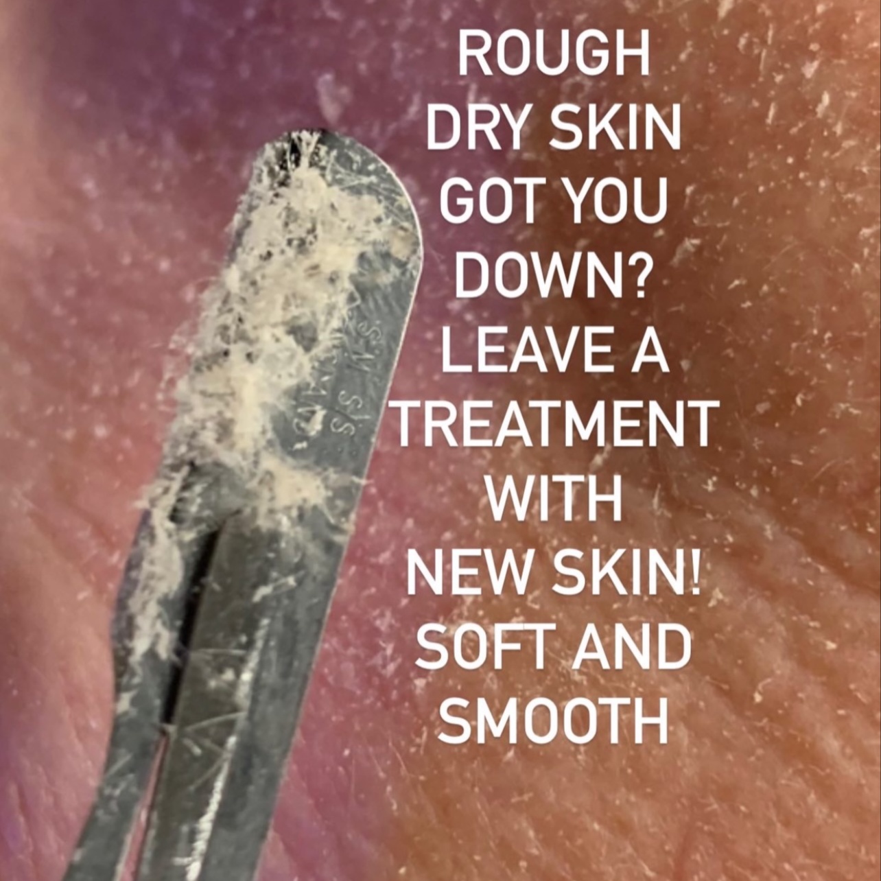 Deluxe Dermaplaning at Plush Spa in Joplin, MO
