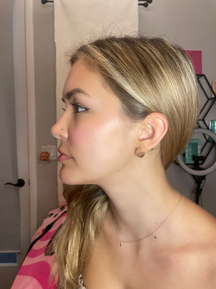 chin filler