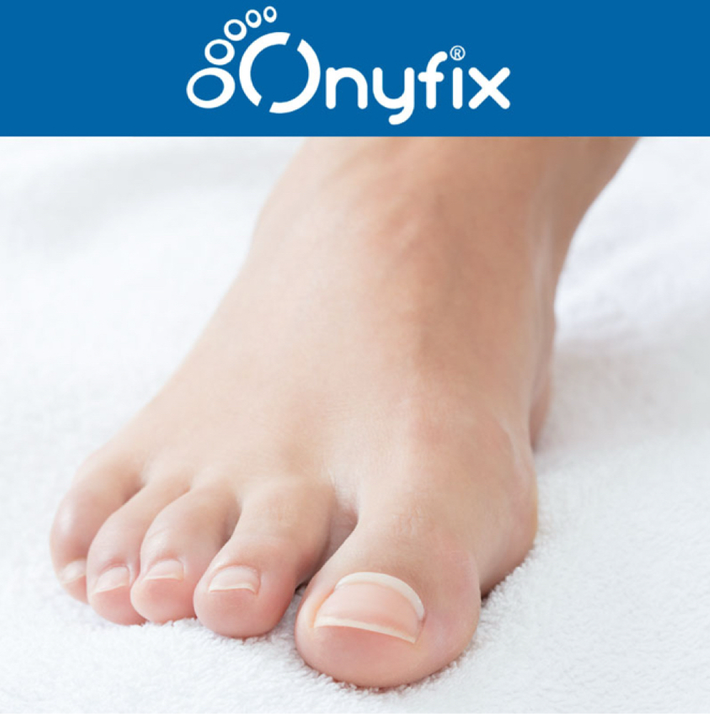 ONYFIX Nail Correction System at Sanctuary Day Spa in Leland, NC