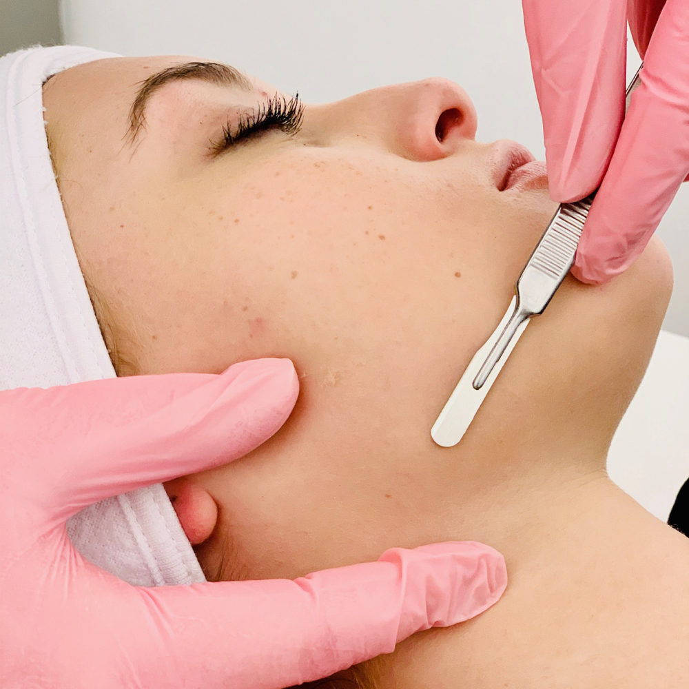 Dermaplane Facial at Pure Serenite Spa in Fairbury, NE