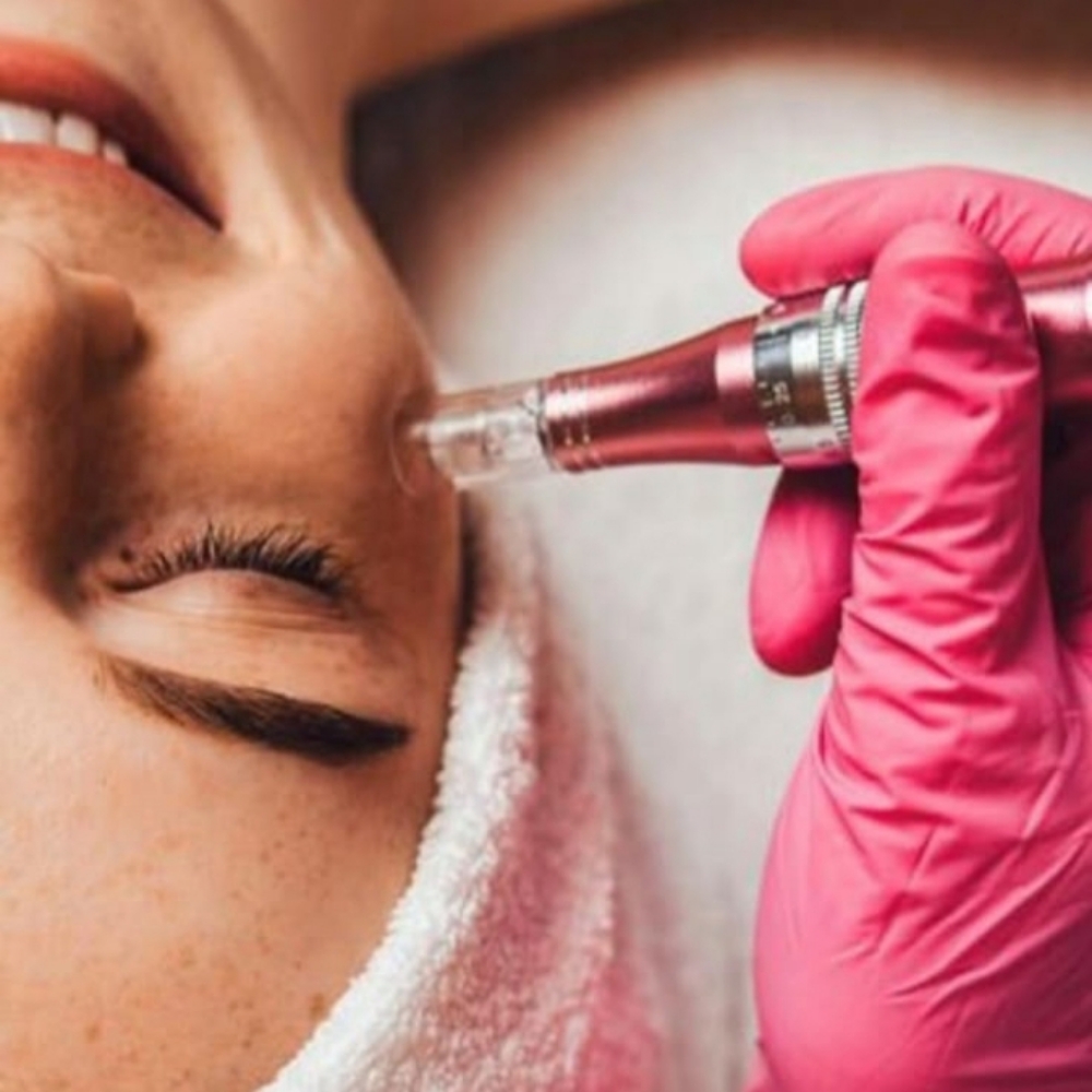 Microneedling at Golden Body Artistry in Oak Hill, WV