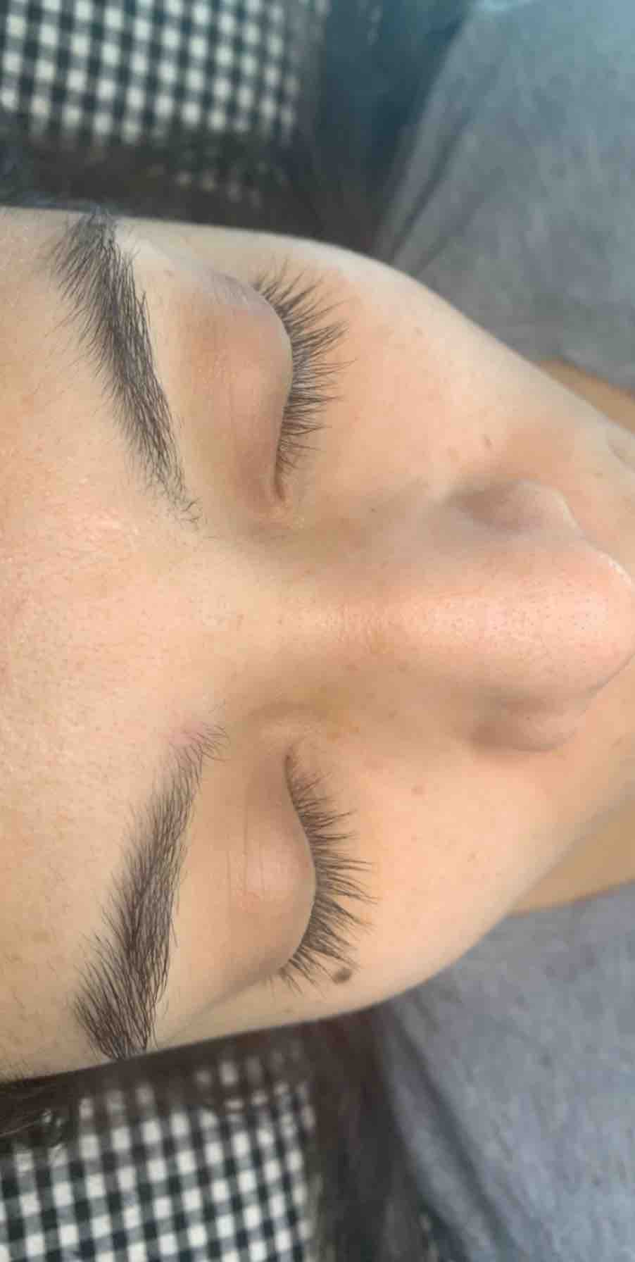 Eyelash Removal