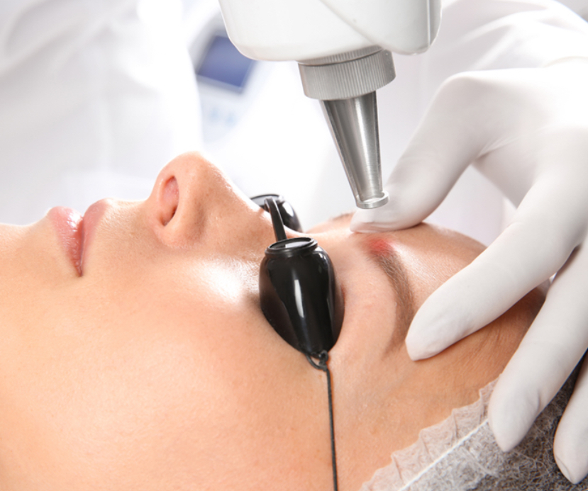 Eyebrow Tattoo Removal