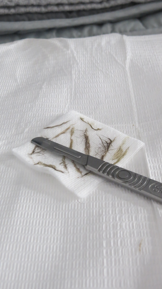 The Dermaplaning Facial
