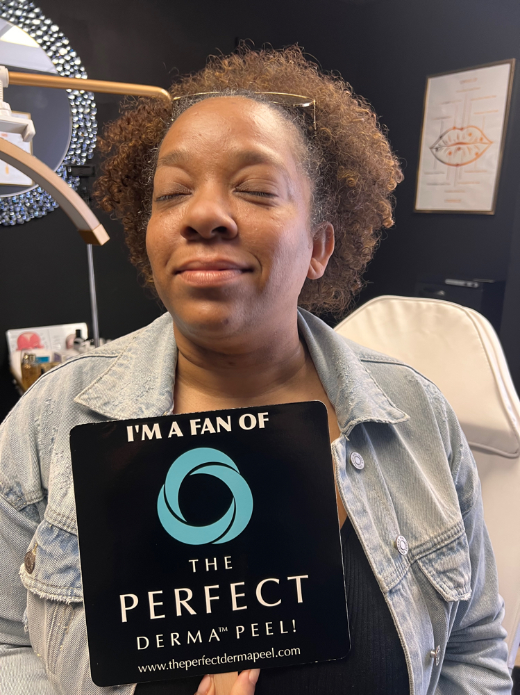 The Perfect DermaPeel Chemical Peel