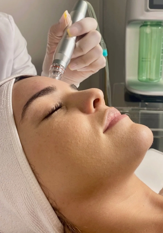 Bio Microneedling