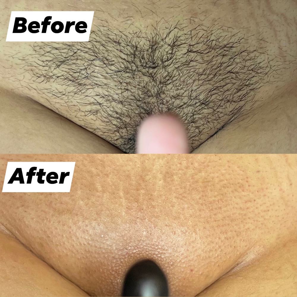 Brazilian Wax