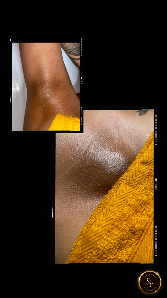 Brazilian/ Underarm