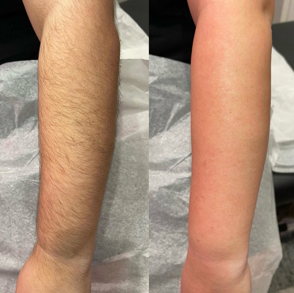 Half Arms Wax