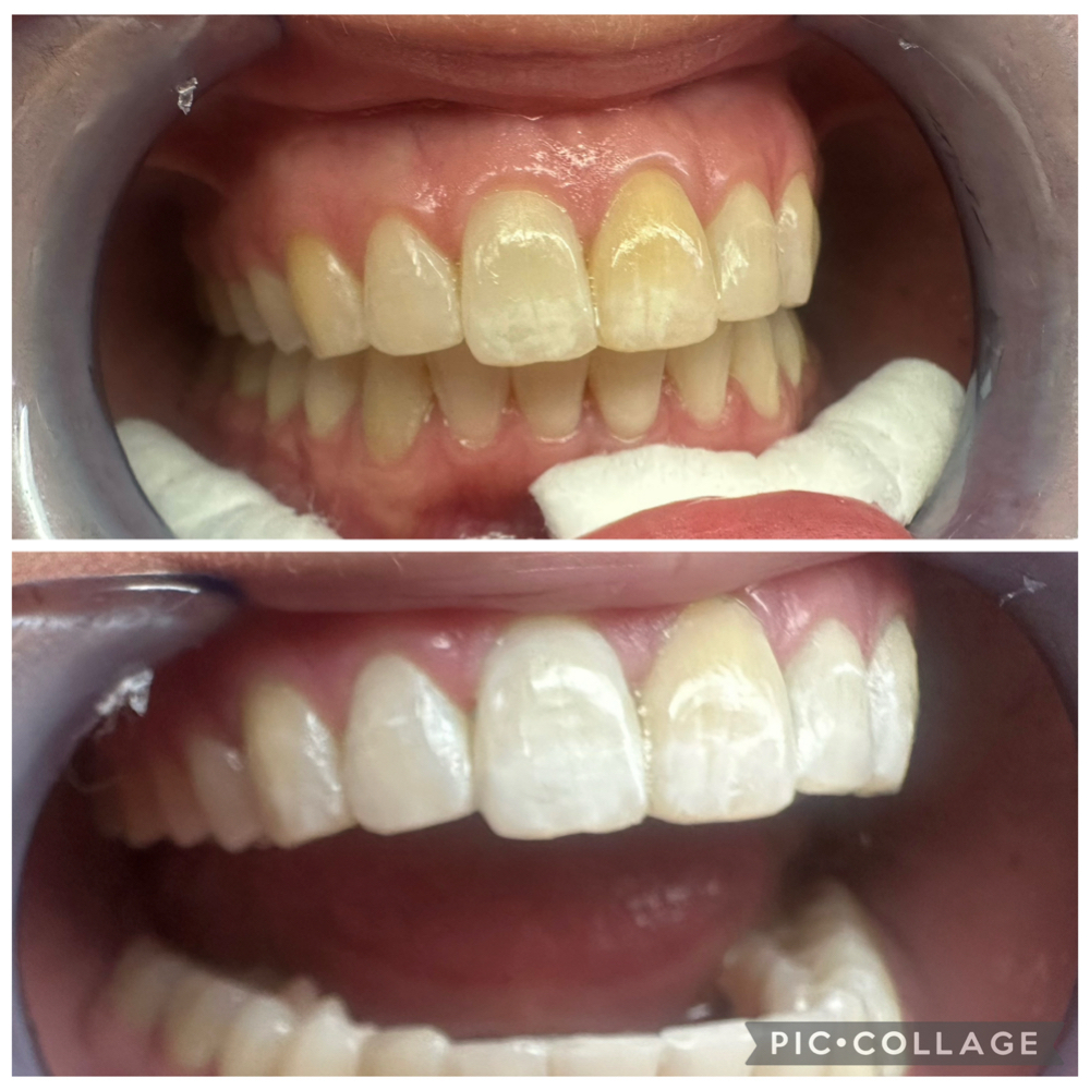 90 minute Teeth Whitening at House of Esthetics LLC in Casa Grande, AZ