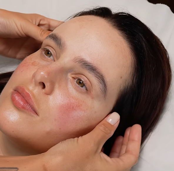 Custom Chemical Peels at Signature Skin Spa in Scottsdale, AZ