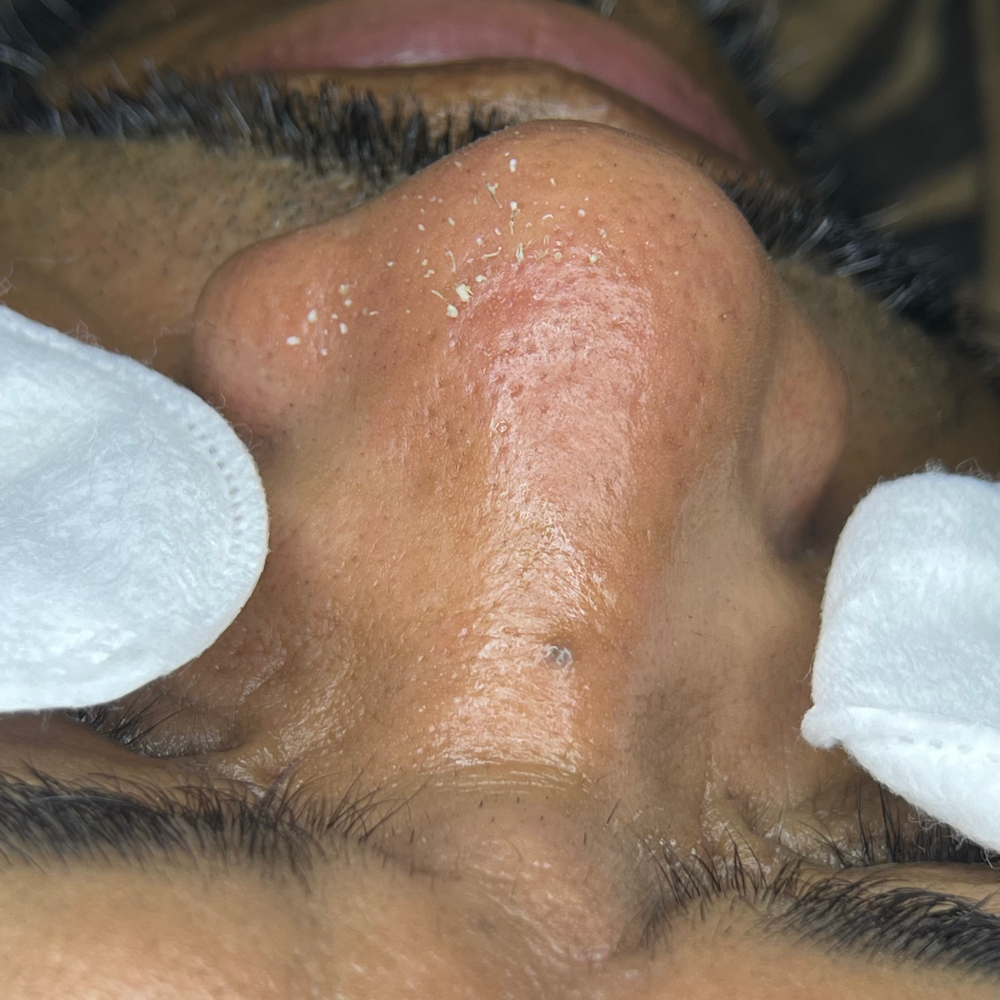 Men Facial