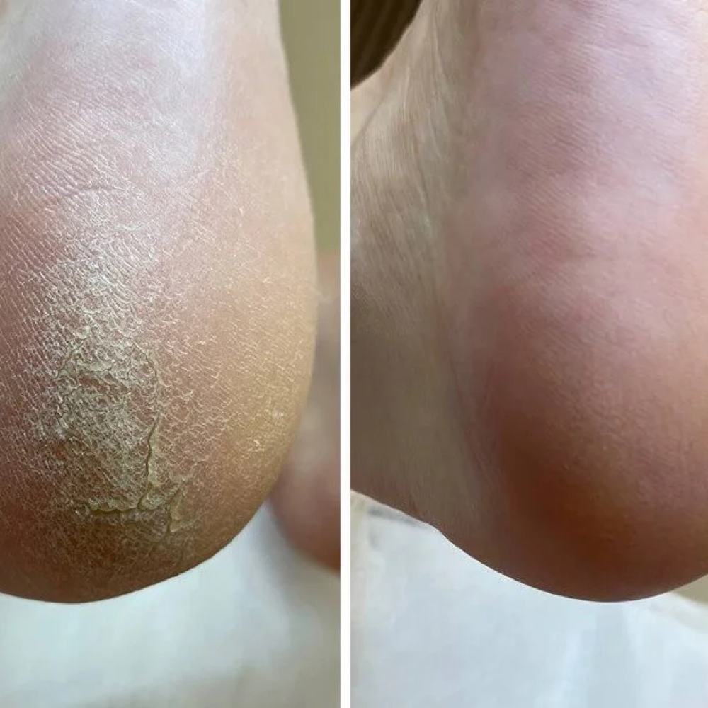 Intermediate Russian Dry Pedicure at Nails by Stephanie Pediet in Allentown, PA