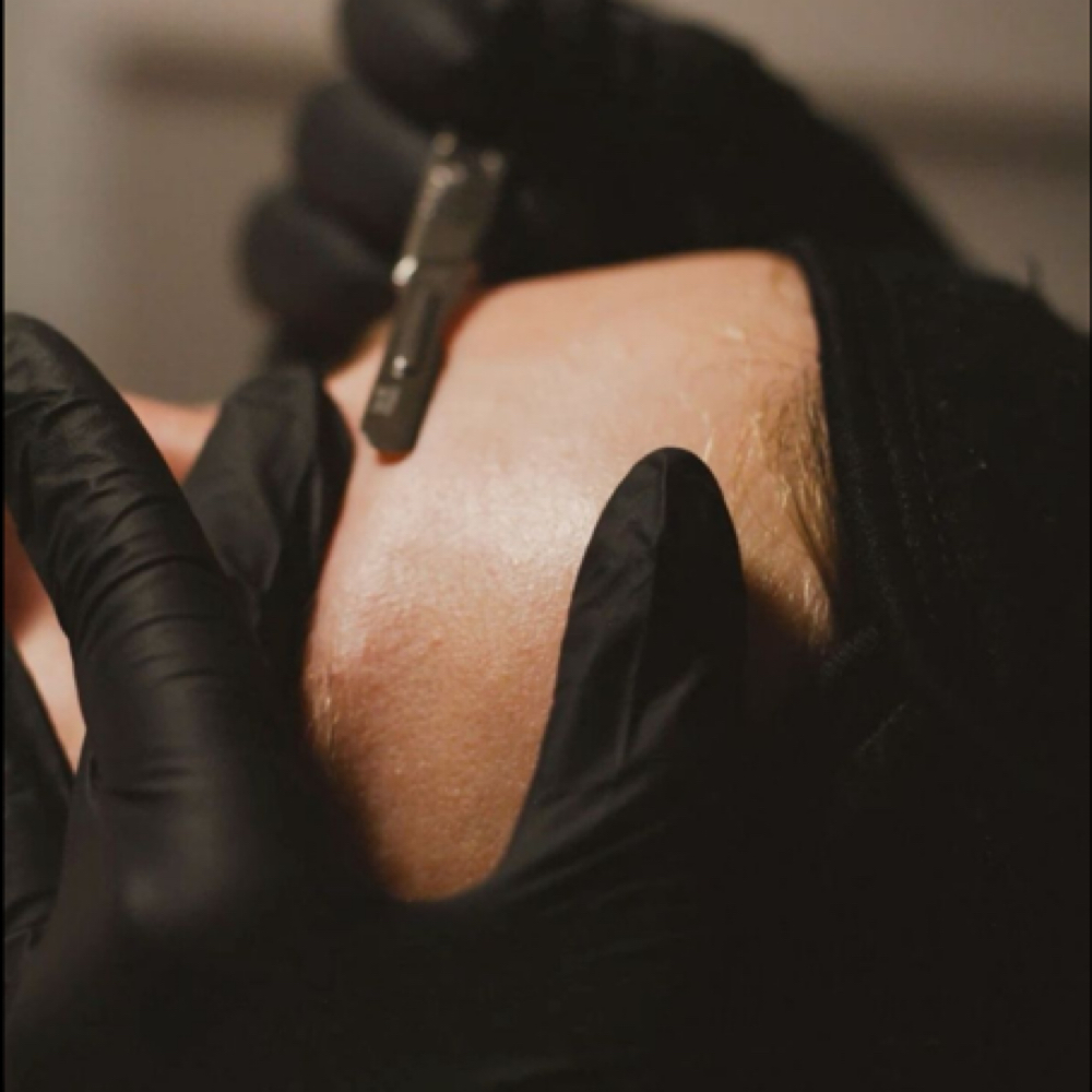 Dermaplane Facial at Care By Kay in Woodbridge, VA