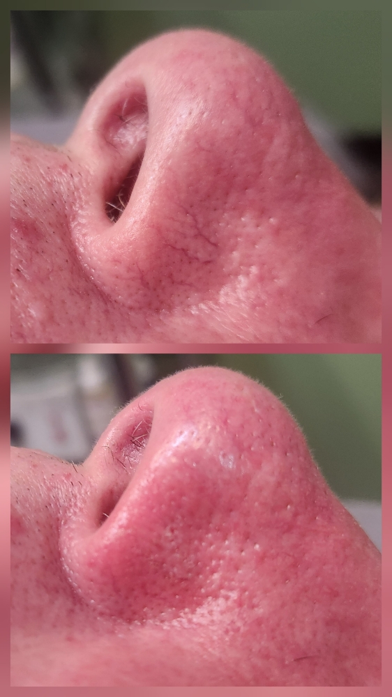 Skin Irregularity Consultation & TX