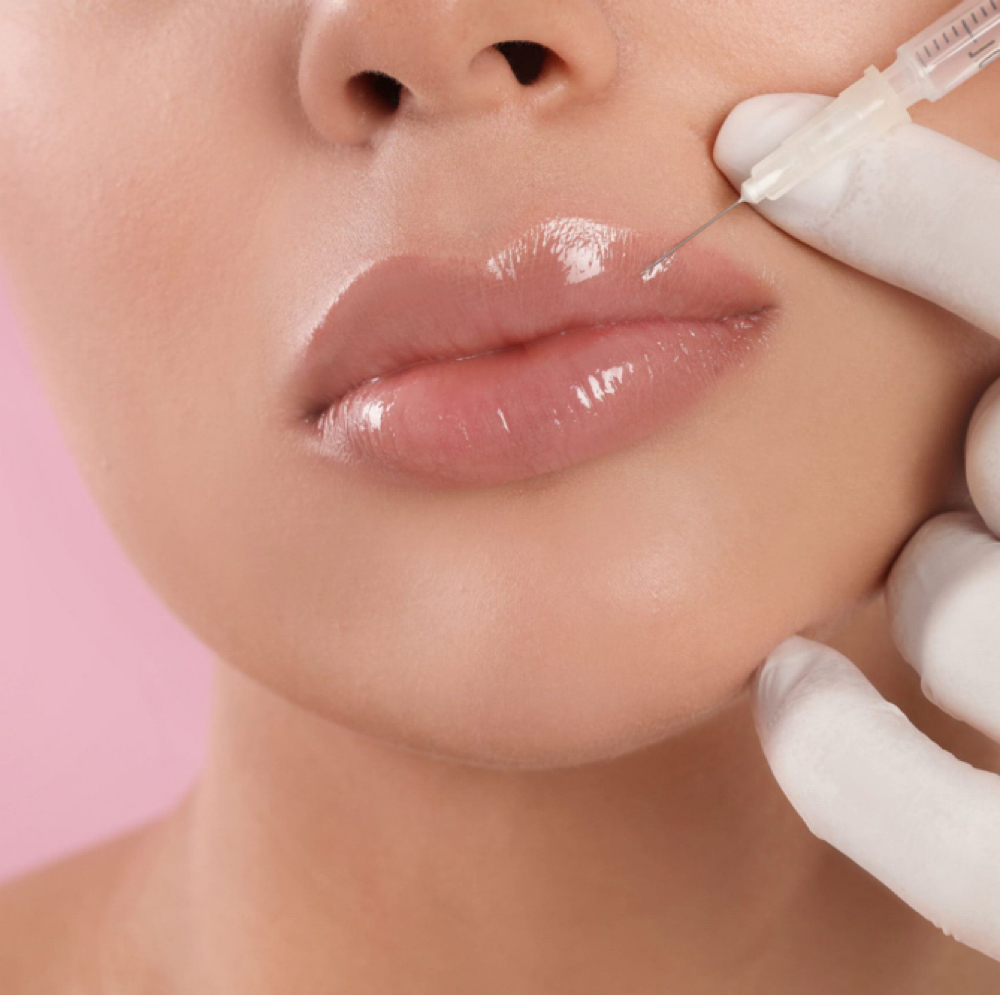Lip Flip at THRYV Aesthetics & Wellness in Lutherville-Timonium, MD