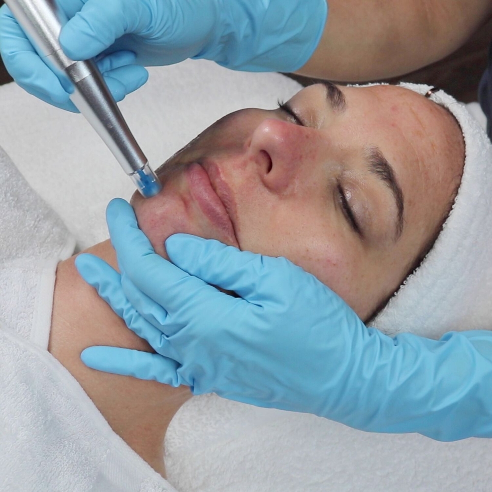 Rezenerate Nano Infusion Facial