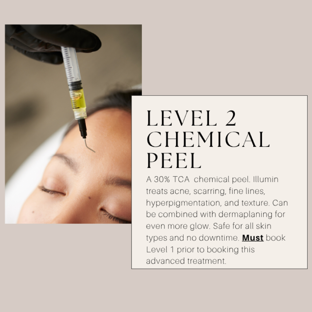 Level 2 - Chemical Peel at Cozy Studio in Astoria, NY