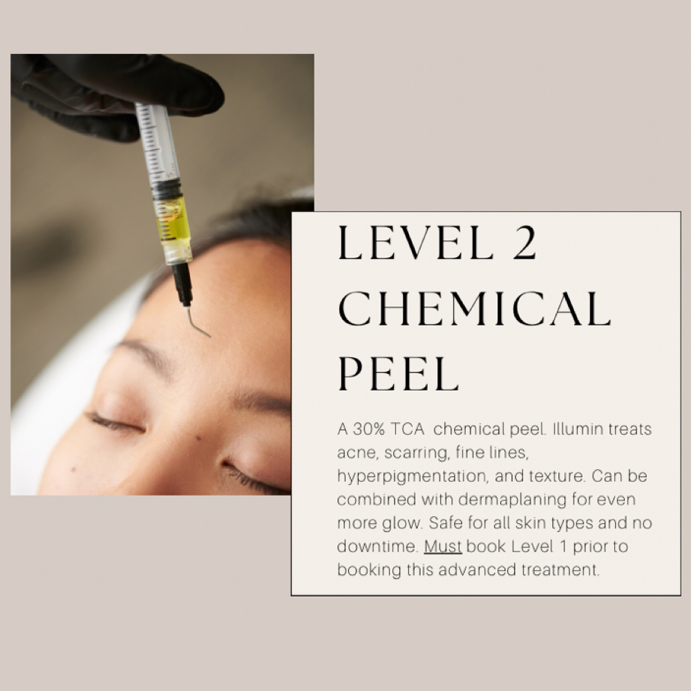 Level 2 - Chemical Peel at Cozy Studio in Astoria, NY