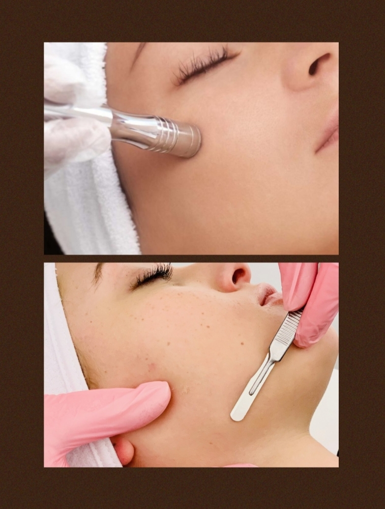 Microderm/ Dermaplaning Facial