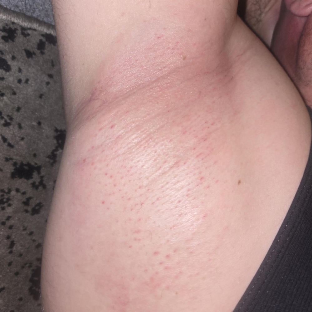 Underarm waxing at LOOK in San Bernardino, CA