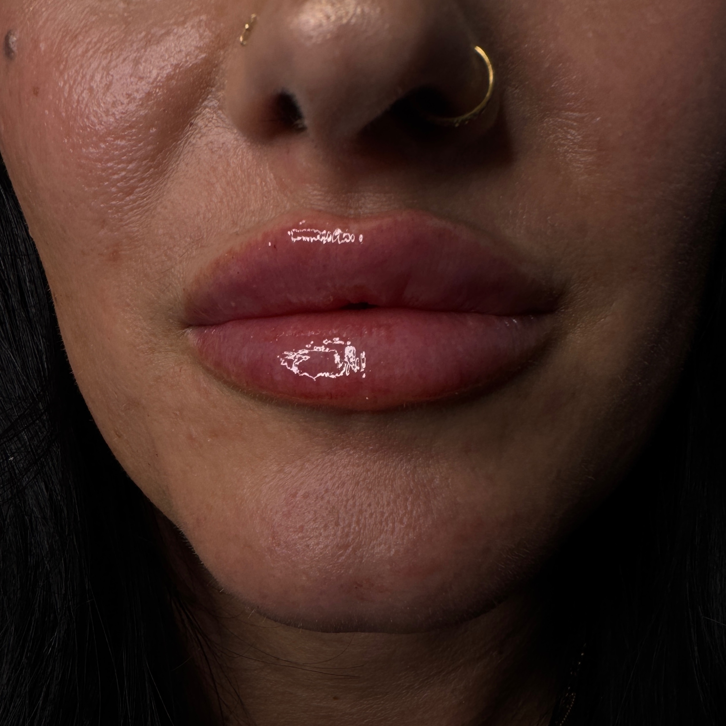 ✪ Lips Allure ✪ at InjectorFaiiry in Greenville, TX