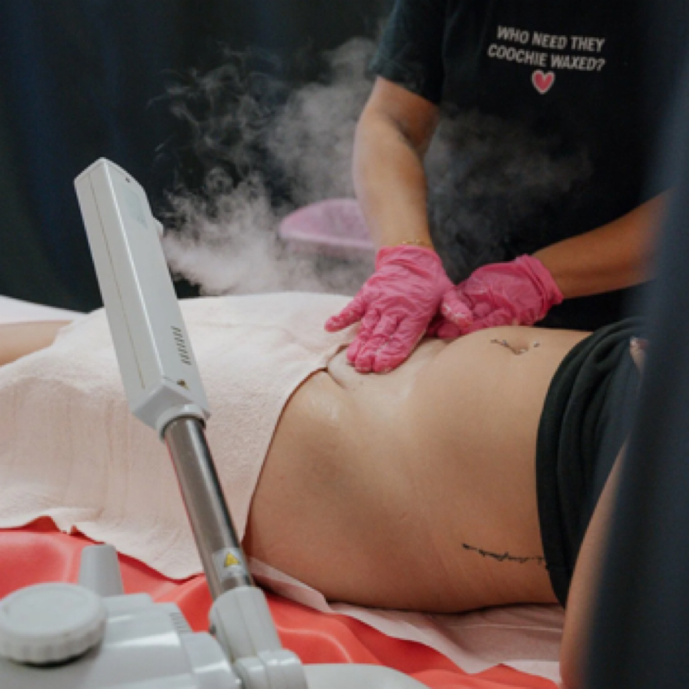 Vajacial at Beauty And Body in San Dimas, CA