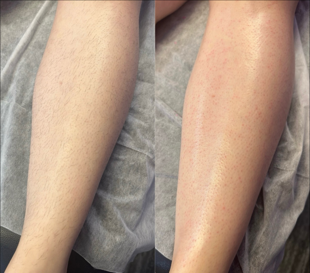 Full Leg Wax