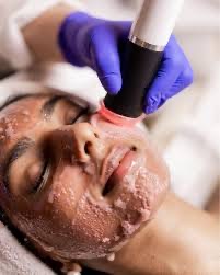 OxyGeneo Facial