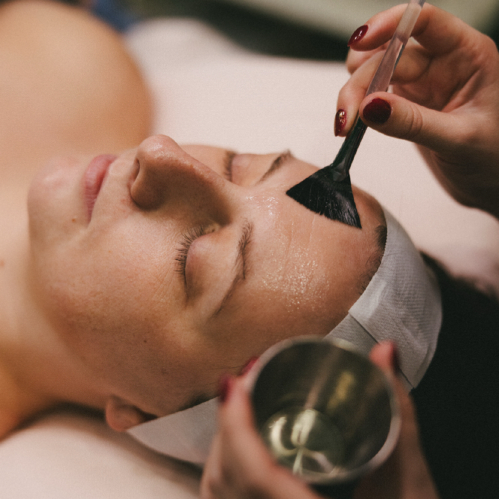 TCA Depigmentation Chem Peel at Royal Esthetics in Kearney, NE