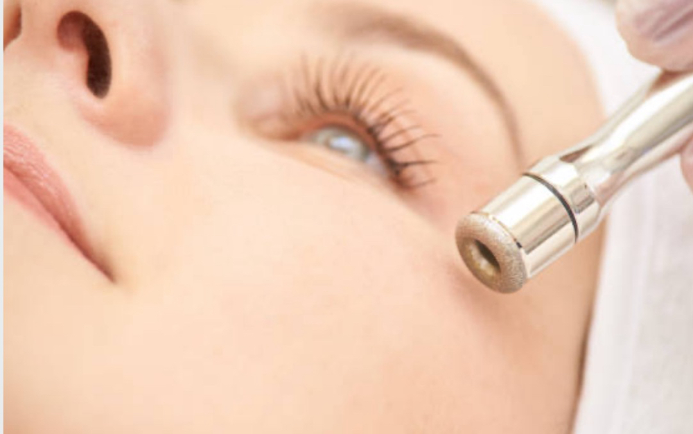 Microdermabrasion Added To Facial
