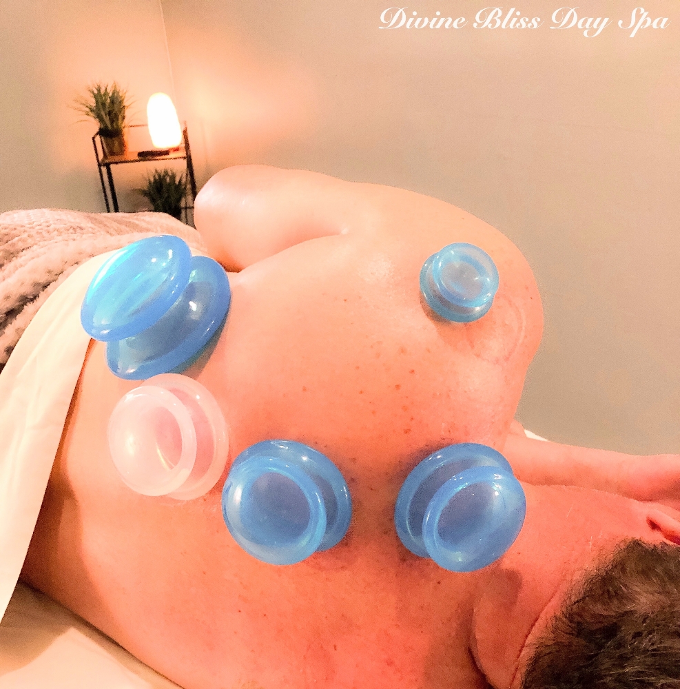 Neuromuscular Cupping Therapy