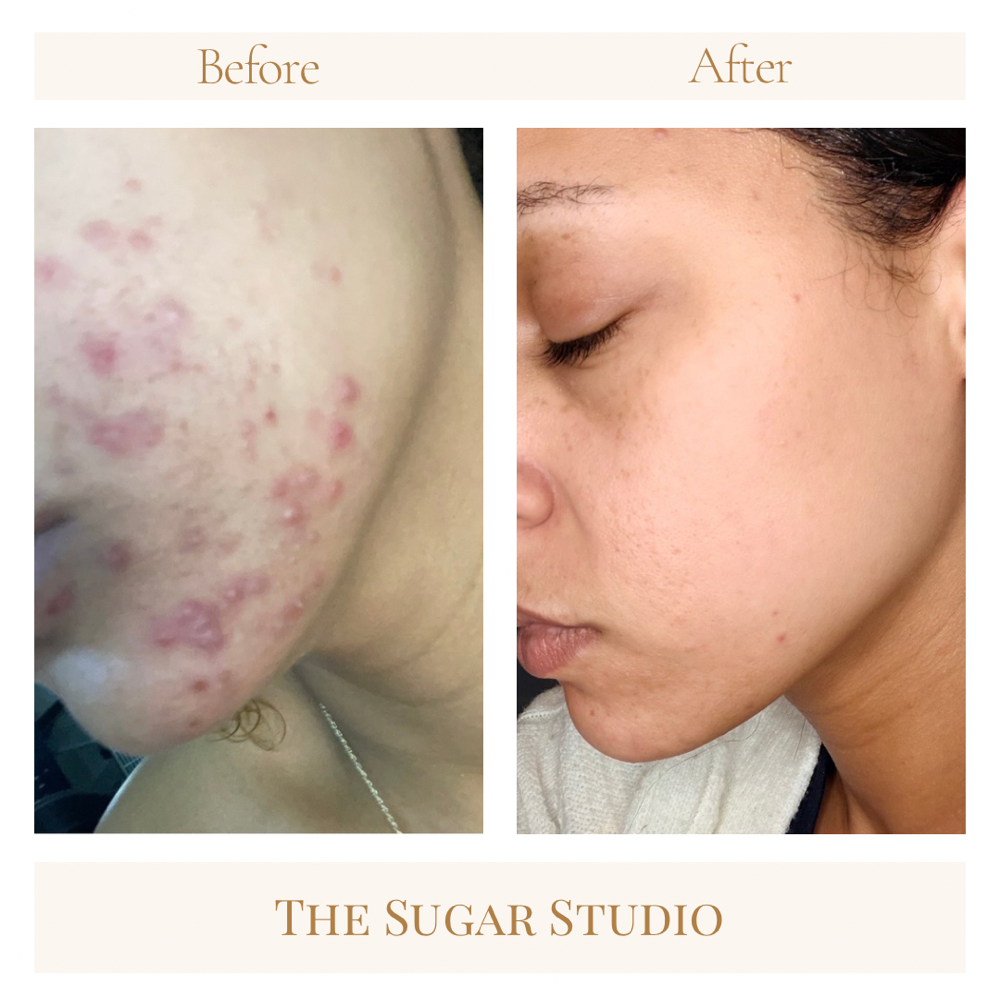 Virtual Self-Care Consultations at The Sugar Studio in Granger, IN