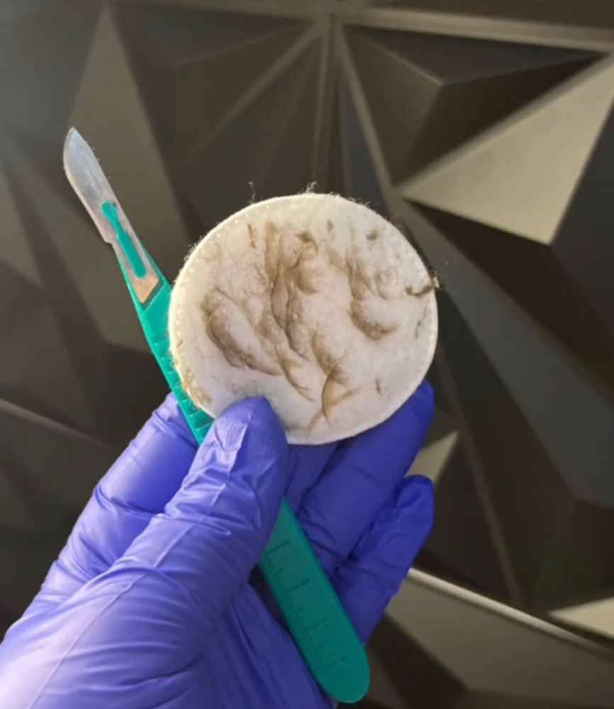 Dermaplaning Facial