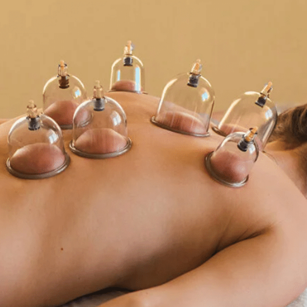 Cupping Therapy at Lymphs Massage in Los Angeles, CA