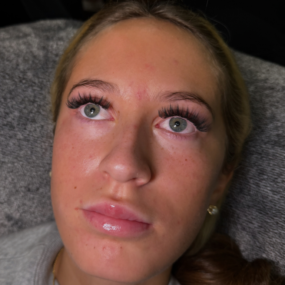 UV fill at lauren delvichio in salem, OH