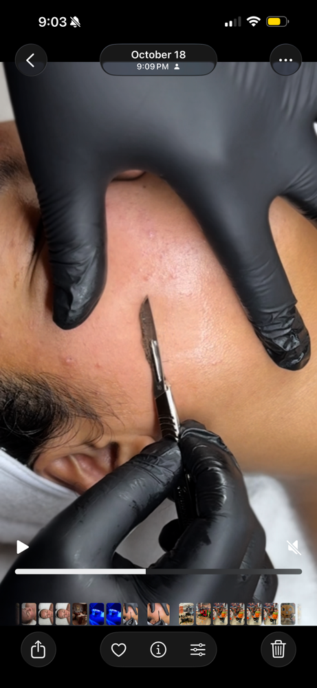 Facial Enhancement-Dermaplaning