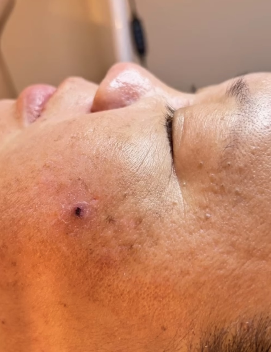 Deep Cleansing/Teen Facial