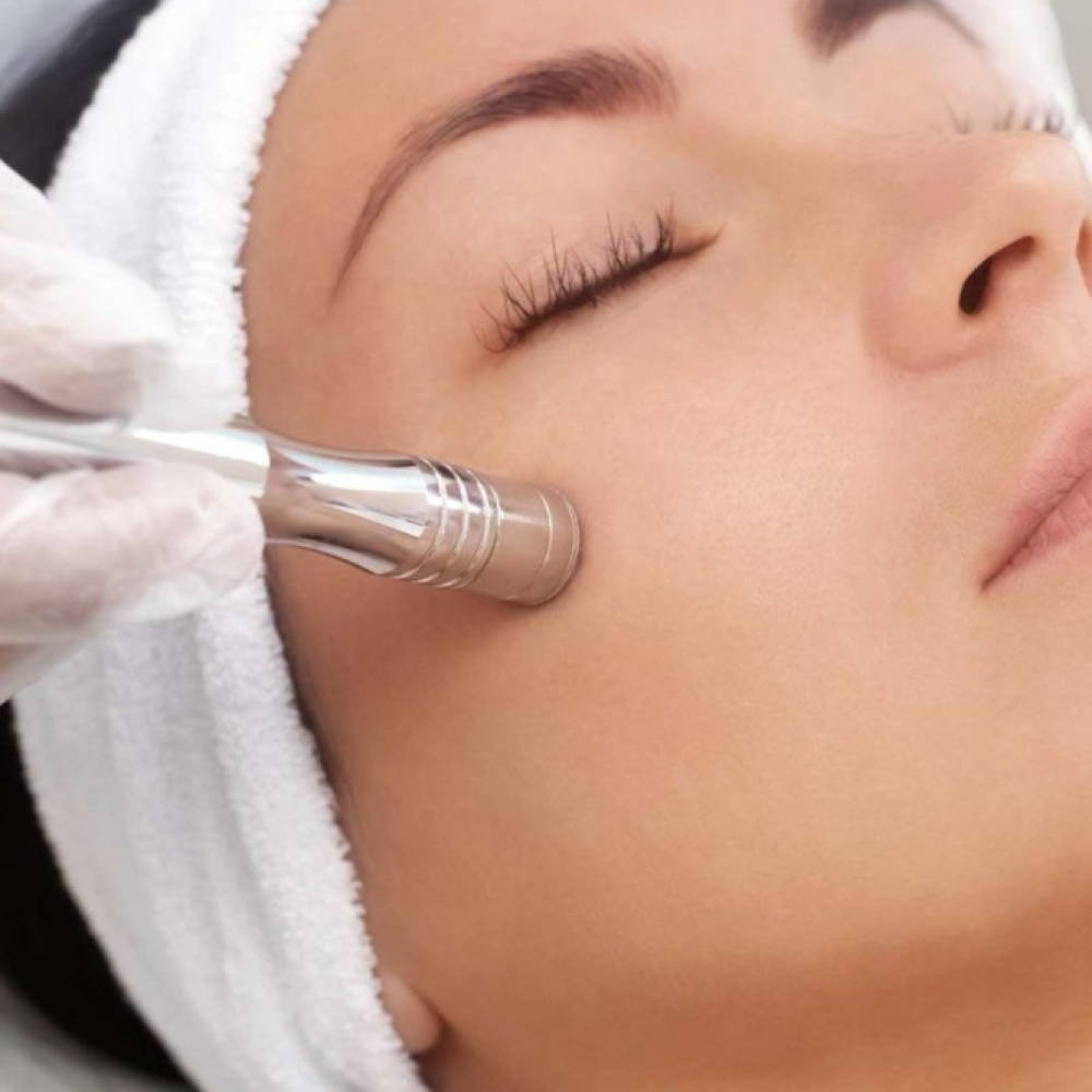 Age Smart Microdermabrasion Facial at LauLux Esthetics in Bellerose, NY