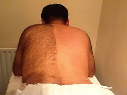 Back