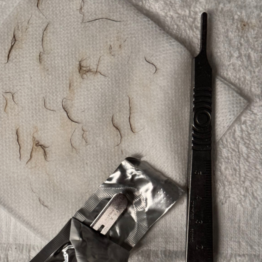 Dermaplane Add On at Bare + Balanced Aesthetics in Hudson, WI