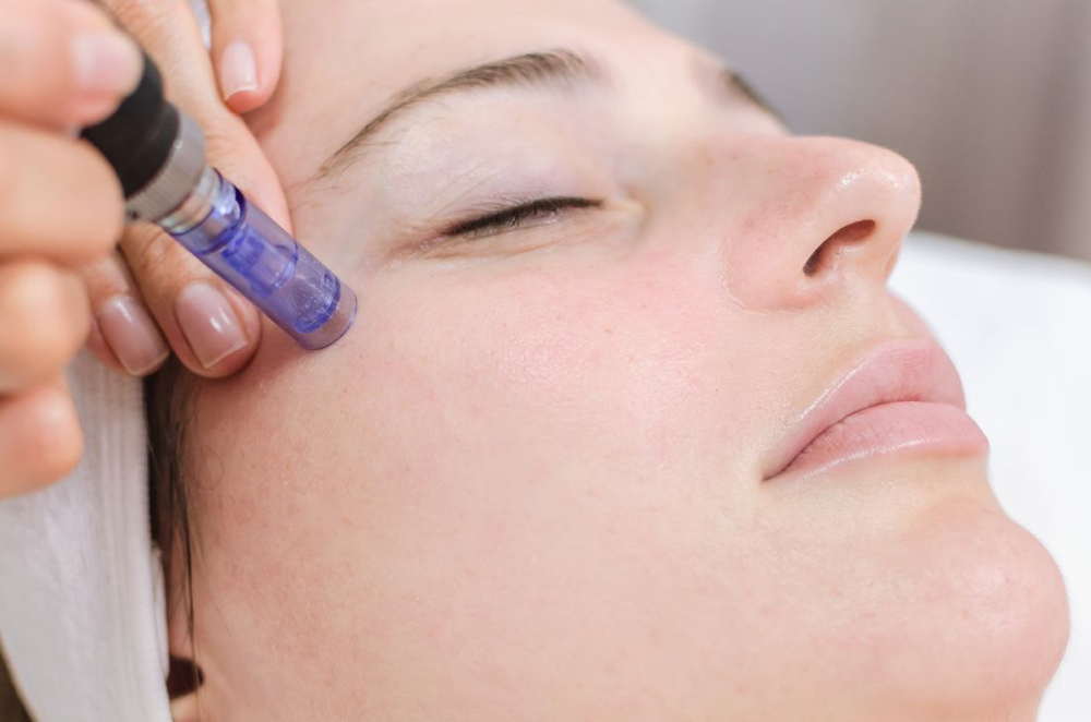 Face Micro Needling PA