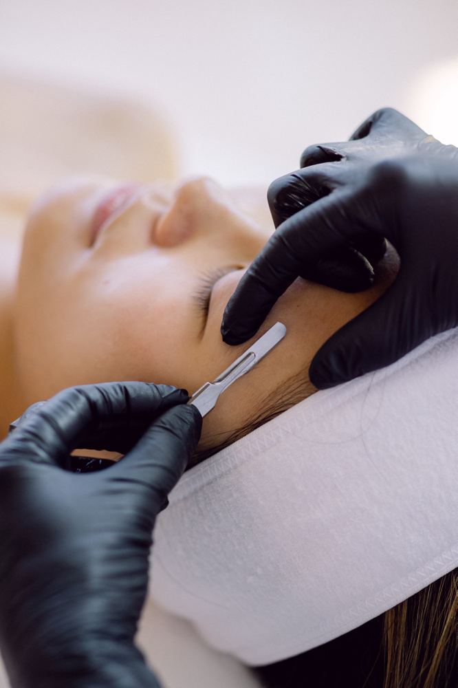 Dermaplaning