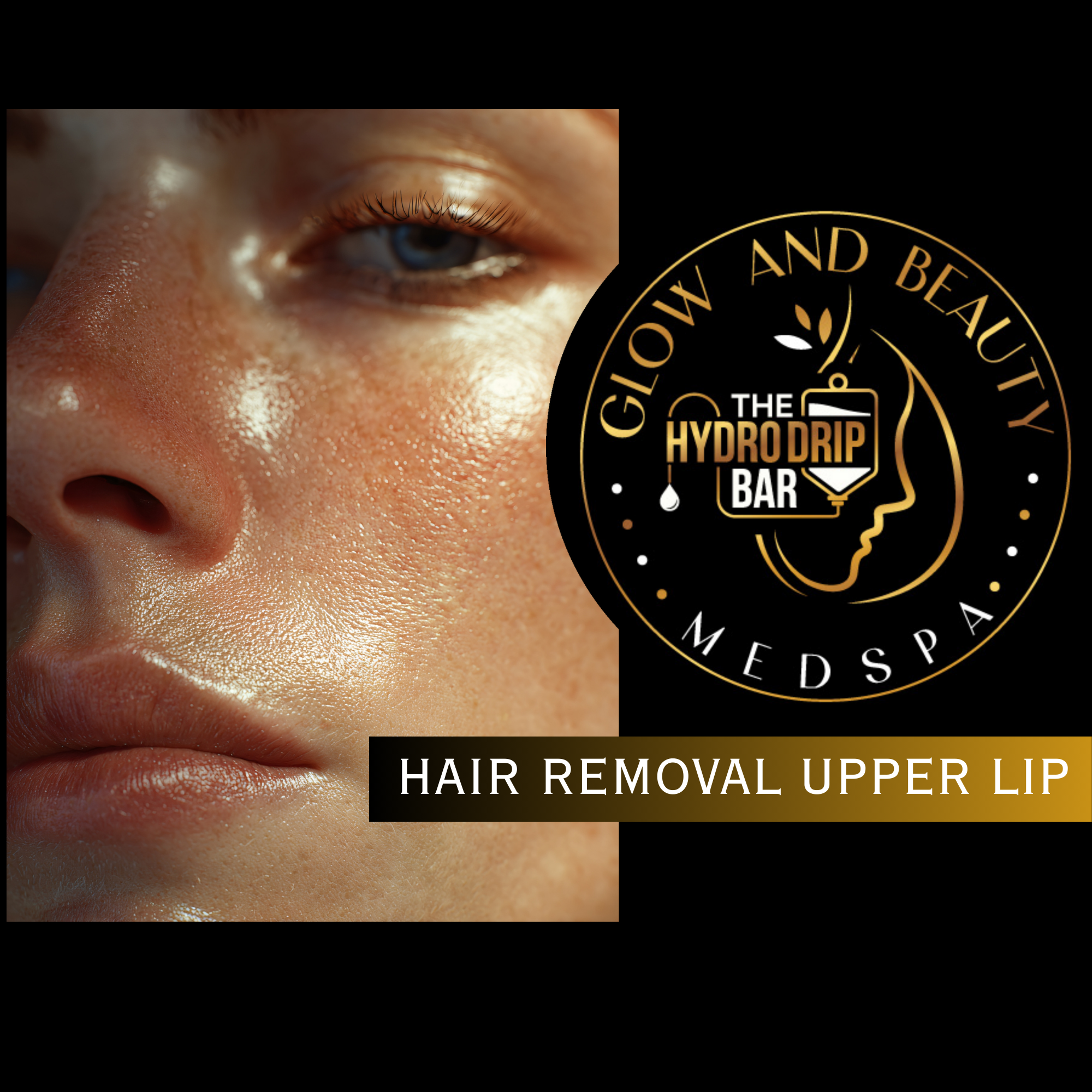 Hair Removal - Upper lip