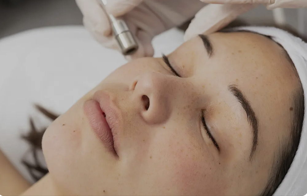 Diamond Dermabasion Radiance Facial