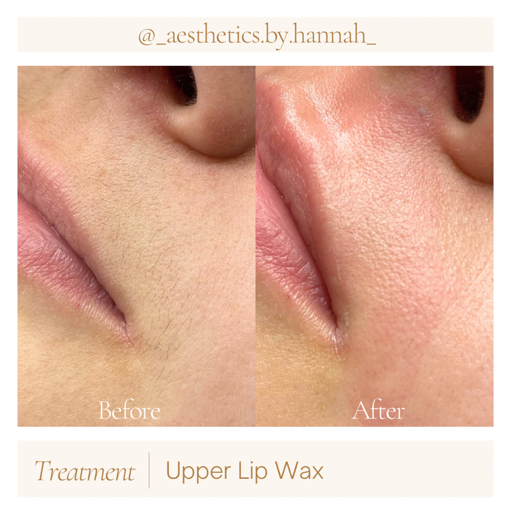 Upper Lip Wax