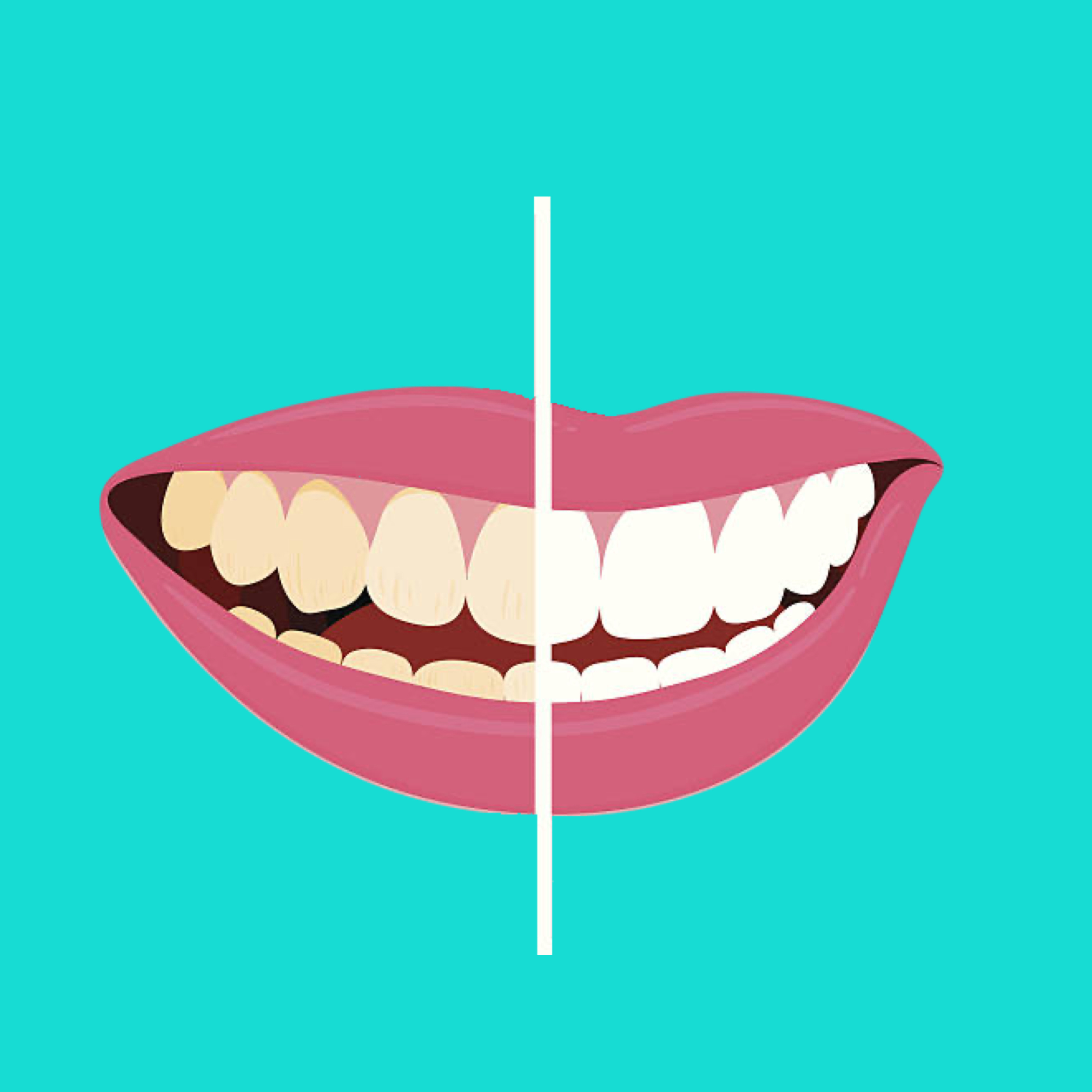 NuYu Teeth Whitening