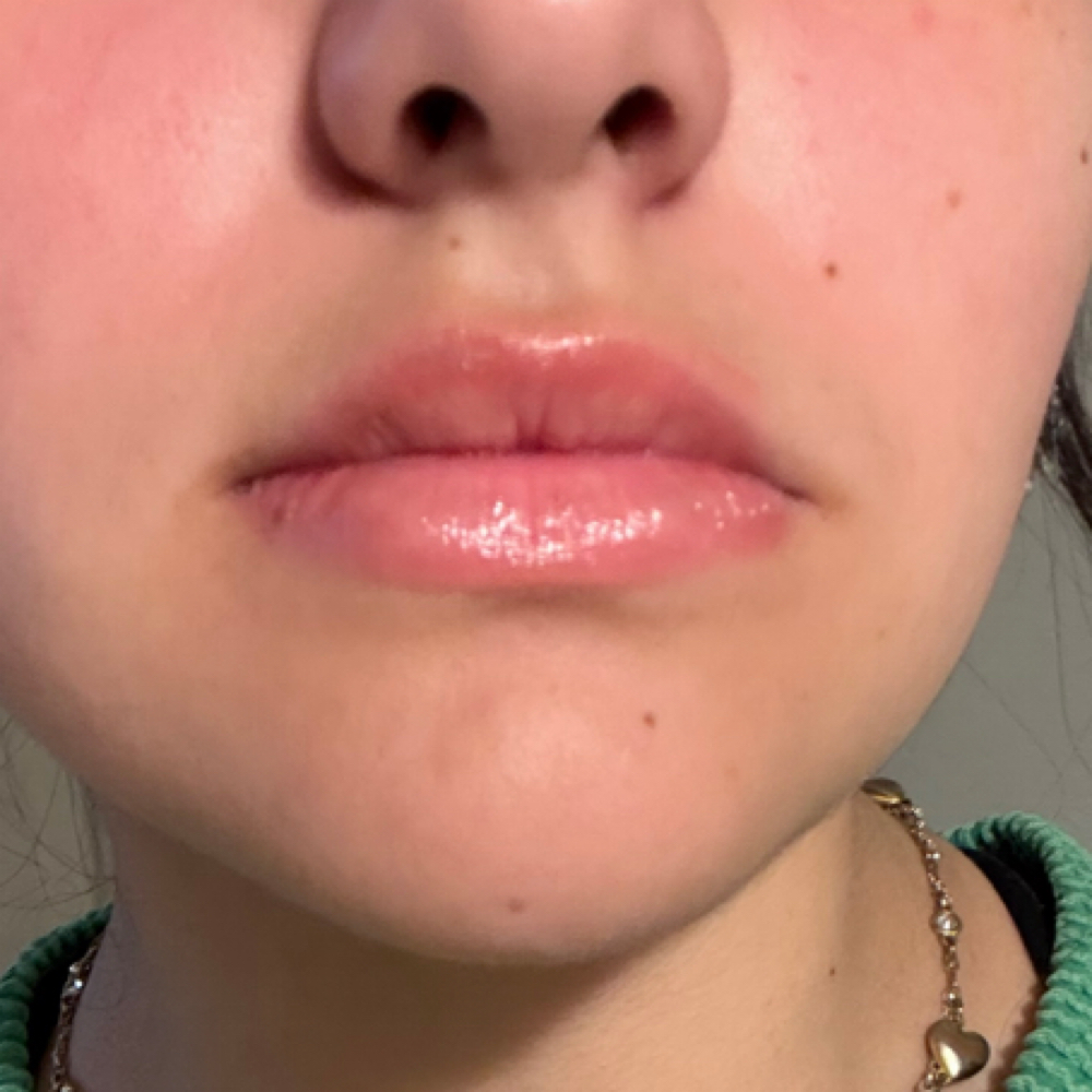 Lip flip at Booking site for Mely & Kaila in Lubbock, TX