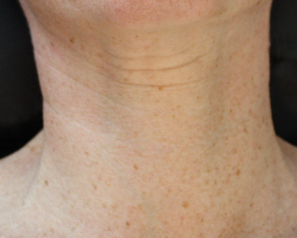 Neck