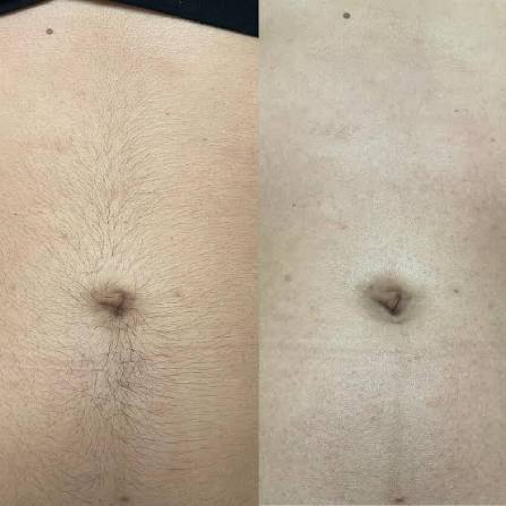 Stomach Strip at Belladz Wax Studio in Beltsville, MD
